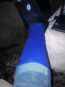 cast